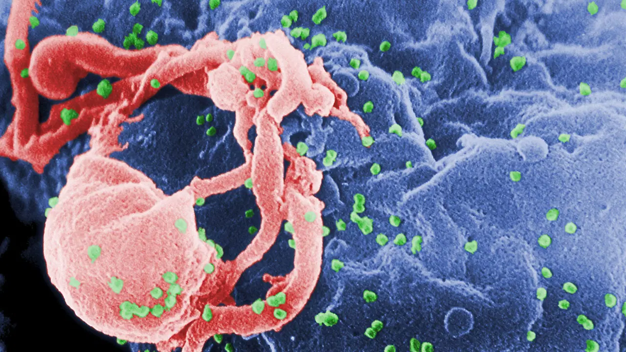 turkiyede yapilan calismada hiv ile yasayan her 3 kisiden 1inde frengi goruldu Pklir1Wh